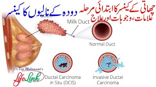 Ductal Carcinoma in Situ DCIS  Successful Natural Treatment of Breast Cancer [upl. by Jan]