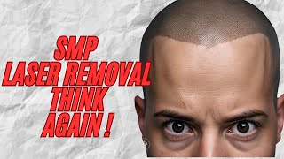 SMP Laser Removal Top 5 Questions Answered By Dr Messina [upl. by Eeresed39]