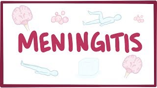 Meningitis  causes symptoms diagnosis treatment pathology [upl. by Jethro798]