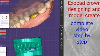 Exocad 30 Galway  How to Make ModelsMaking Models in ExocadExocad Model creatorexocad design [upl. by Geffner173]