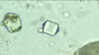 Calcium oxalate Crystal [upl. by Aira]