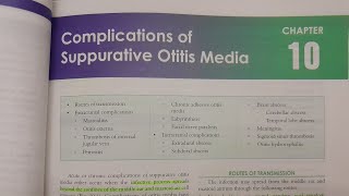 Complications of Suppurative Otitis Media  ENT [upl. by Neik958]