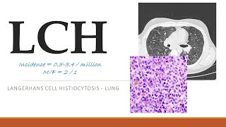 LCH  Unraveling LANGERHANS CELL HISTIOCYTOSIS A Comprehensive Guide [upl. by Ennahteb]