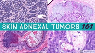 Skin Adnexal Tumors 101 A Basic Approach for General Pathologists [upl. by Margaretha684]