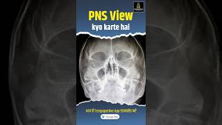 PNS View Xray  Pns view kyo karte hai  pns xray xraytechnicians pnsview drtclasses shorts [upl. by Grenier]