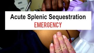 Sickle Cell Splenic Sequestration Emergency [upl. by Derdlim]