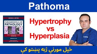 Hypertrophy VS Hyperplasia  Dr Sadiq Ali [upl. by Lougheed161]