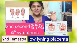 Low lyning placenta  placenta previa 2nd trimester in pregnancy viralvideo trending vlogs [upl. by Tomkins]