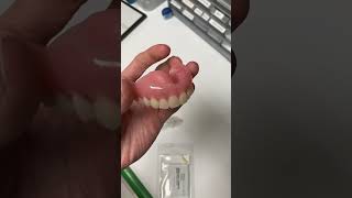 Implant Supported Dentures [upl. by Anirba272]