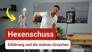 Hexenschuss erklärt  Das ist die wahre Ursache ⚡ [upl. by Ahseuqal]