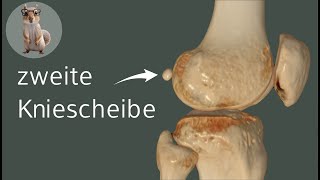 Die zweite Kniescheibe  die Fabella anatomie medizin anatomy [upl. by Eciened]