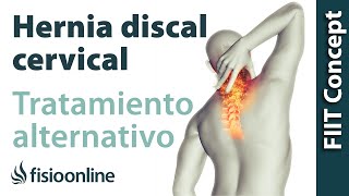 Hernia discal cervical derecha  Visión desde la fisioterapia y la medicina natural [upl. by Beattie327]