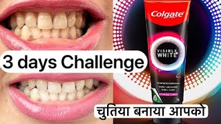 Colgate Visible White 02 Toothpaste Review Get Whiter Teeth in 3 Days Exposed [upl. by Orrocos]