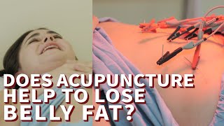 Medilog Korean traditional medicine for weight loss Does acupuncture help to lose belly fat [upl. by Iras]