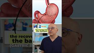 Gastric Balloon vs Endoscopic Sleeve Recovery [upl. by Mit]