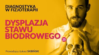 Dysplazja stawu biodrowego Diagnostyka w fizjoterapii Odcinek 25 [upl. by Alage680]