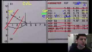 Spirometrie 2  valorile esentiale de urmarit pe o spirometrie [upl. by Keary]