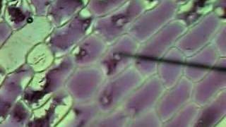 Onion Cells Plasmolysis [upl. by Alphonsine]