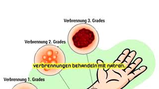 Verbrennungen behandeln mit Natron [upl. by Alius]