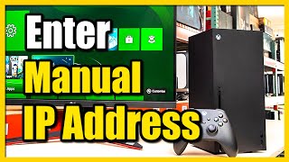 How to Enter a Manual IP Address on Xbox Series X Static IP Tutorial [upl. by Limak]