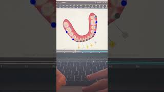 TIP 270  SPEE CURVE  DIASTEMAS  PROBLEM [upl. by Dauf]