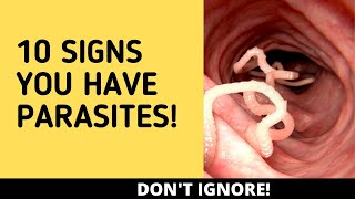 10 Symptoms of a Parasite Infection DONT IGNORE [upl. by Seerdi]