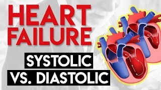 Systolic vs Diastolic Heart Failure  Heart Failure Part 2 [upl. by Rolo]