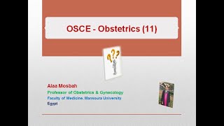 OSCE  Obstetrics 11 [upl. by Ahsael]