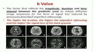 Diffusion MRI [upl. by Hotze83]