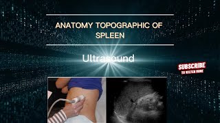 ULTRASOUND OF THE SPLEEN Normal Echograophy of the Normal Spleen Échographie de la rate normale [upl. by Cesare416]