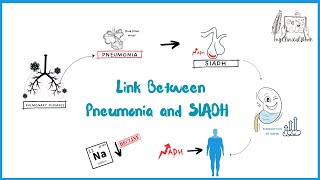 Understanding the Link Between Pneumonia and SIADH  it’s MyClinicalBook [upl. by Beattie]