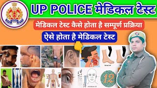 UP POLICE medical video मेडिकल में क्याक्या चेक होता हैUP police medical 2023 [upl. by Armin]