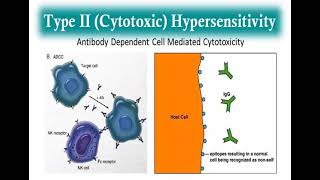 10 Hypersensitivity reactions Type 2  3 and 4 Hypersensitivity reactions شرح بالعربي [upl. by Eriha]