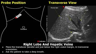 Liver Ultrasound Probe Positioning  Transducer Placement For Liver Scanning  Abdominal USG [upl. by Barde]