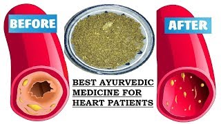 Ayurvedic Cure for Blocked or Clogged HeartArteries  NO SIDE EFFECTS  Homemade Medicine for HEART [upl. by Marquardt]