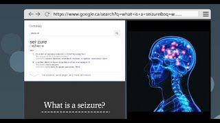 What Are Seizures and How to Recognize Them [upl. by Linsk]