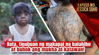 Bata tinubuan ng makapal na balahibo at buhok ang mukha at katawan  Kapuso Mo Jessica Soho [upl. by Elocin644]