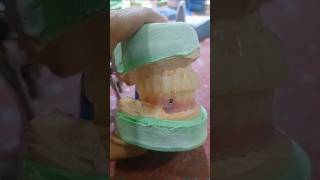 PMMA temporary crown for try inimplantdentistry dentaltechnology dentist dentallabtech [upl. by Staffan]