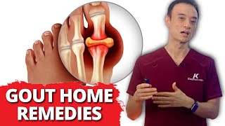 Relief Fast 6 Home Remedies For Gout [upl. by Aleta]