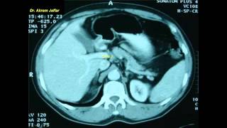 Cross sectional and imaging anatomy of the abdomen [upl. by Fezoj]