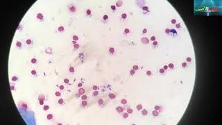 leishmania under the microscope  leishmaniose  الليشمانيا [upl. by Lemaj]