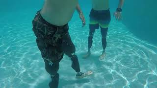 Dream Team Prosthetics presents Genium X3 Waterproof Knee [upl. by Llenreb68]