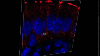 Listeria monocytogenes in Mouse Ileal Tissue [upl. by Neyu]