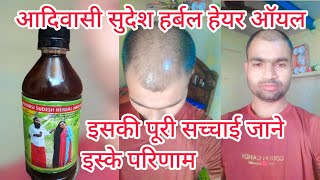 Adivasi Hair oil review iske puri sachai jane [upl. by Yddor]