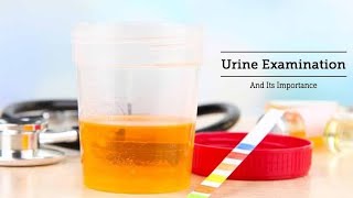 Urine Examination learned in sixty seconds and its importance Dr Health Officials [upl. by Clio532]