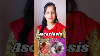 Ascariasis  protozoan disease🦠causes symptoms  transmission ascaris neet biology shortvideo [upl. by Teryn775]