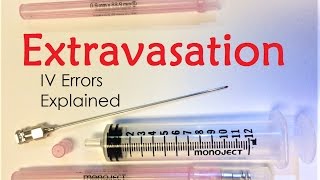 Extravasation  IV Infiltration Errors Explained Doctor Interview [upl. by Asia]