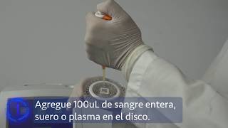 Analizador de Química Clínica SMT100V [upl. by Altis]