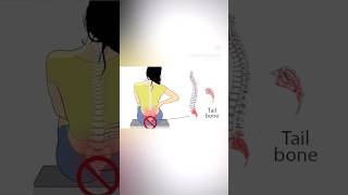 Coccydynia exercises coccydynia physio physiotherapy [upl. by Andrew]