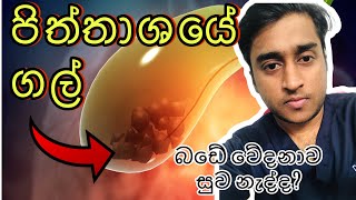 පිත්තාශයේ ගල්  ලක්ෂණ හා ප්‍රතිකාර Gall stones in sinhala [upl. by Anidan]